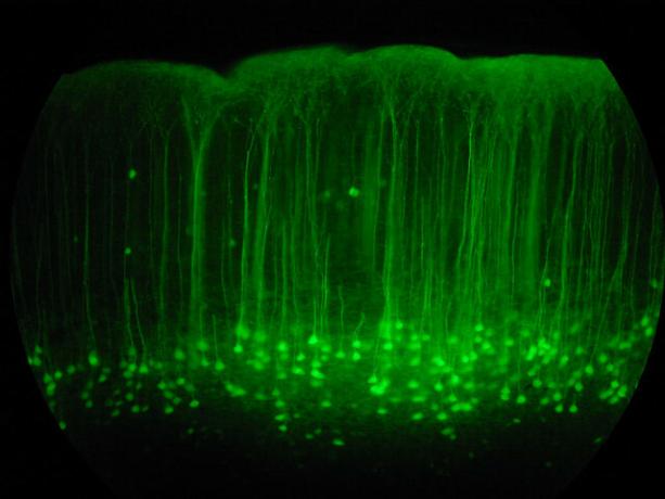 stainedneurons